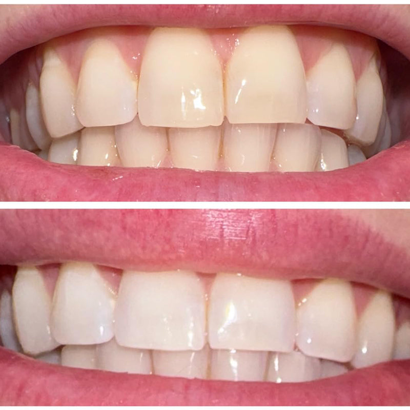 đ§Smileasego⢠Whitening Remineralizing Tooth Powder, Fluoridfrei, Zahnpolitur & Fleckenentferner