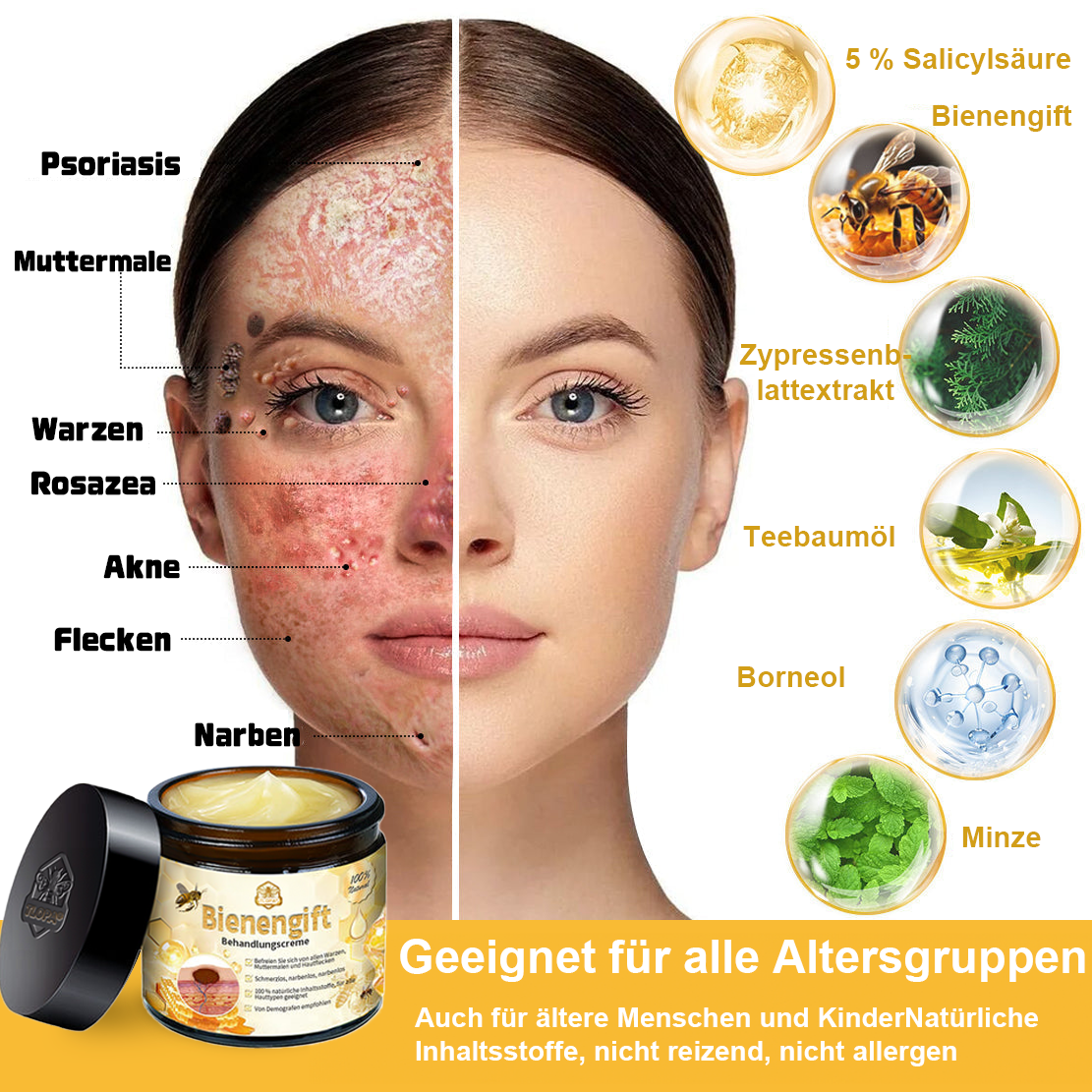 [Zusätzliche 30 % Rabatt] TLOPA® Fortgeschrittene Bienengift Behandlungscreme (🔥Letzter Tag Aktion 80 % Rabatt) 