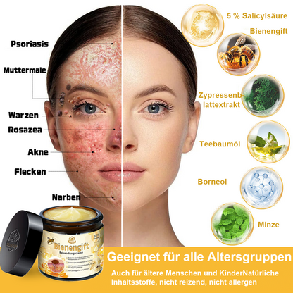 [Zusätzliche 30 % Rabatt] TLOPA® Fortgeschrittene Bienengift Behandlungscreme (🔥Letzter Tag Aktion 80 % Rabatt) 