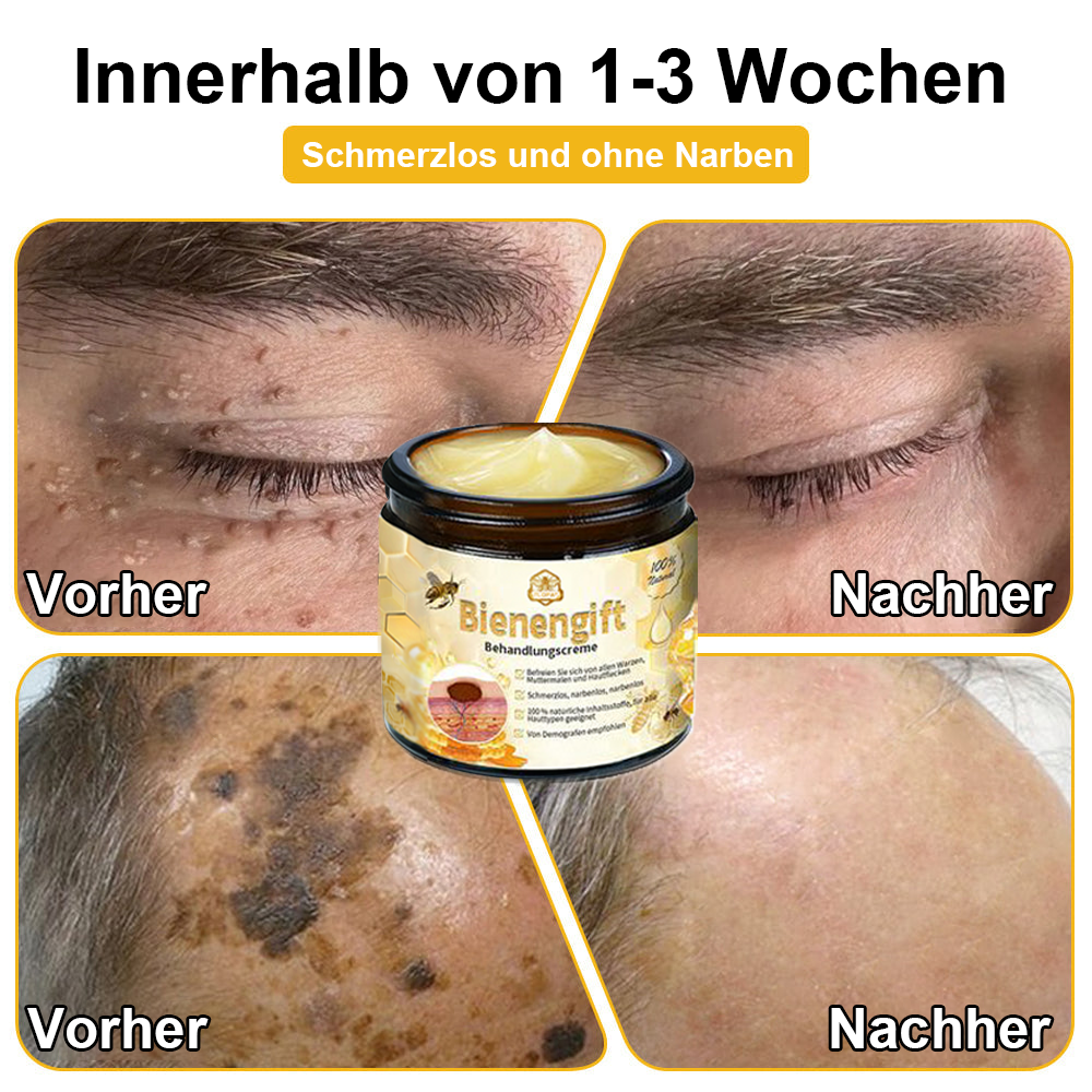 [Zusätzliche 30 % Rabatt] TLOPA® Fortgeschrittene Bienengift Behandlungscreme (🔥Letzter Tag Aktion 80 % Rabatt) 
