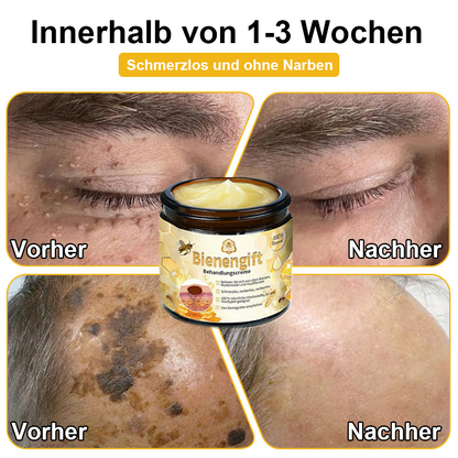 [Zusätzliche 30 % Rabatt] TLOPA® Fortgeschrittene Bienengift Behandlungscreme (🔥Letzter Tag Aktion 80 % Rabatt) 
