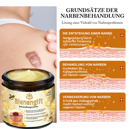 [Zusätzliche 30 % Rabatt] TLOPA® Fortgeschrittene Bienengift Behandlungscreme (🔥Letzter Tag Aktion 80 % Rabatt) 