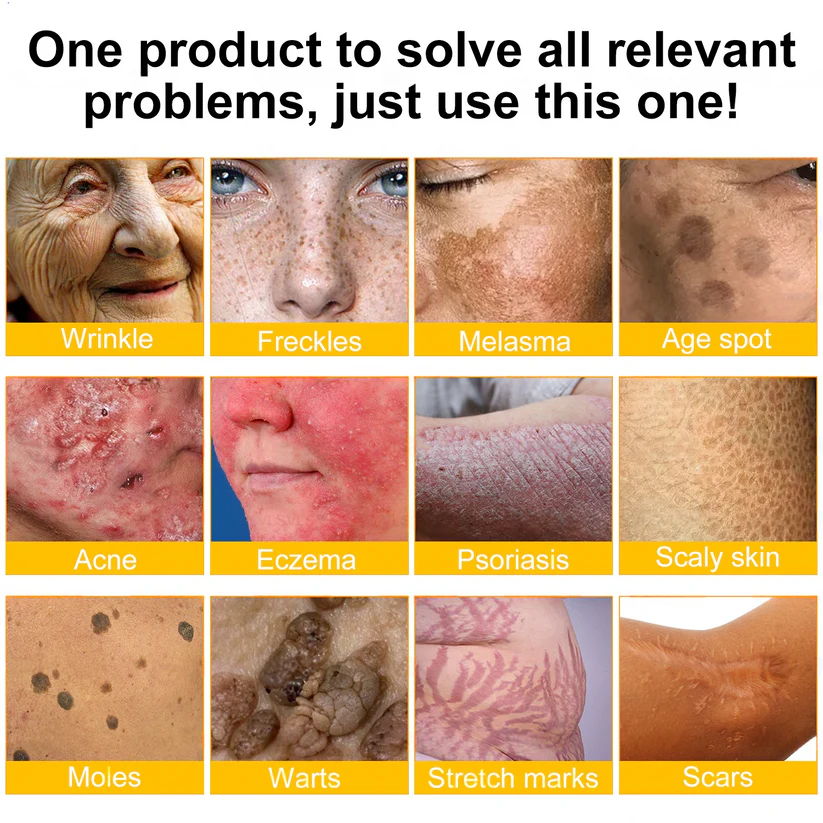 💥TGA-geprüft: Ourlyard® Bee Venom Pro Comprehensive Cream – 🔥Begrenzte Zeit 80 % RABATT🔥
