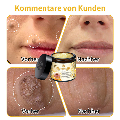 [Zusätzliche 30 % Rabatt] TLOPA® Fortgeschrittene Bienengift Behandlungscreme (🔥Letzter Tag Aktion 80 % Rabatt) 