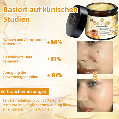 [Zusätzliche 30 % Rabatt] TLOPA® Fortgeschrittene Bienengift Behandlungscreme (🔥Letzter Tag Aktion 80 % Rabatt) 