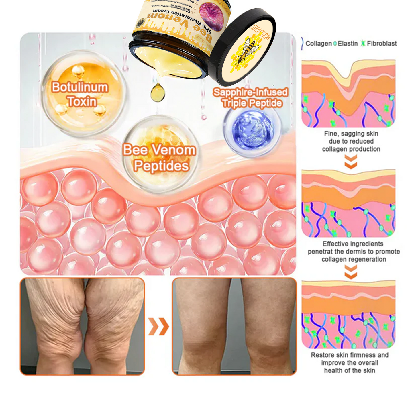 💥TGA-geprüft: Ourlyard® Bee Venom Pro Comprehensive Cream – 🔥Begrenzte Zeit 80 % RABATT🔥